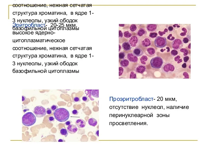 Эритробласт- 20-25 мкм, высокое ядерно- цитоплазматическое соотношение, нежная сетчатая структура хроматина, в ядре