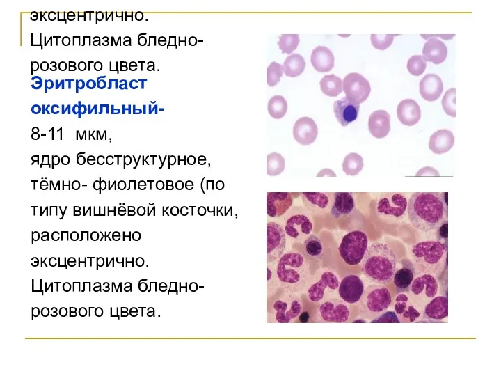 Эритробласт оксифильный- 8-11 мкм, ядро бесструктурное, тёмно- фиолетовое (по типу