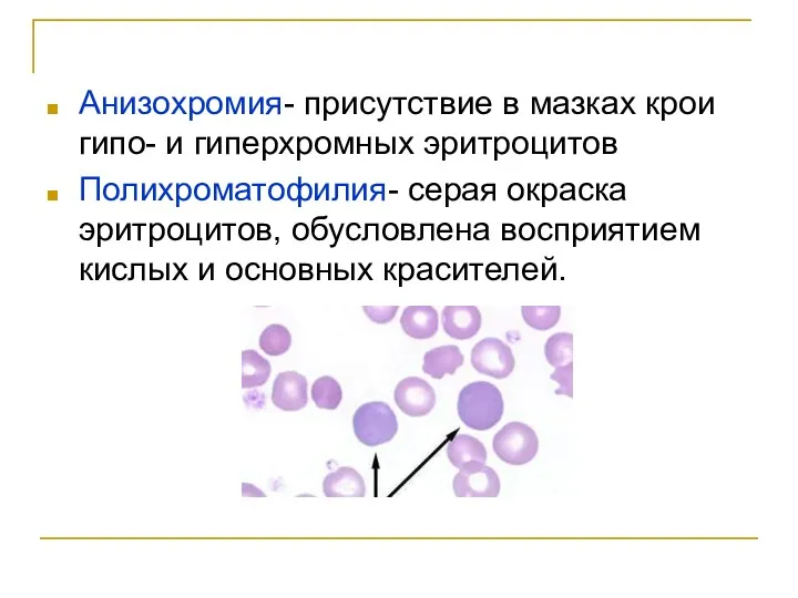 Анизохромия- присутствие в мазках крои гипо- и гиперхромных эритроцитов Полихроматофилия-