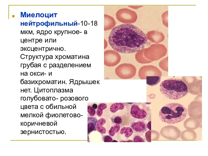 Миелоцит нейтрофильный-10-18 мкм, ядро крупное- в центре или эксцентрично. Структура хроматина грубая с