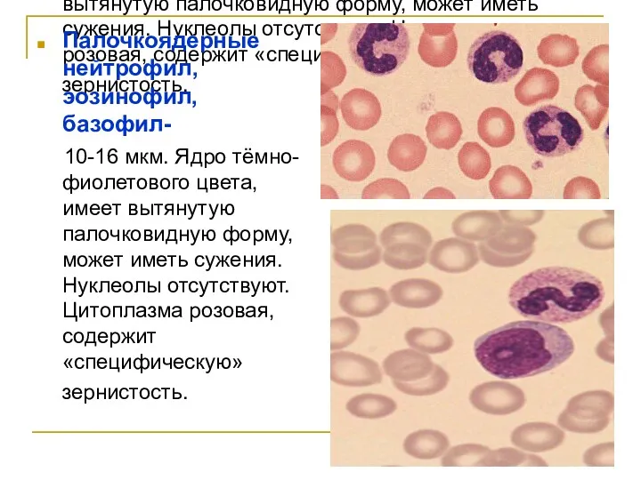 Палочкоядерные нейтрофил, эозинофил, базофил- 10-16 мкм. Ядро тёмно- фиолетового цвета, имеет вытянутую палочковидную