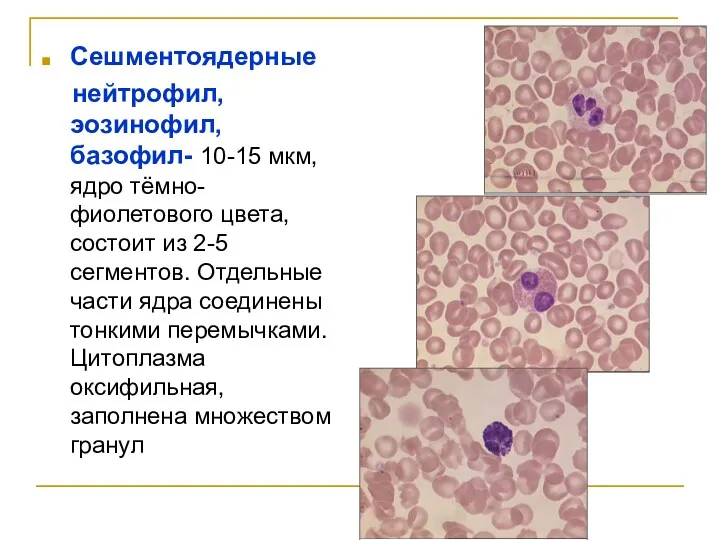 Сешментоядерные нейтрофил, эозинофил, базофил- 10-15 мкм, ядро тёмно- фиолетового цвета,