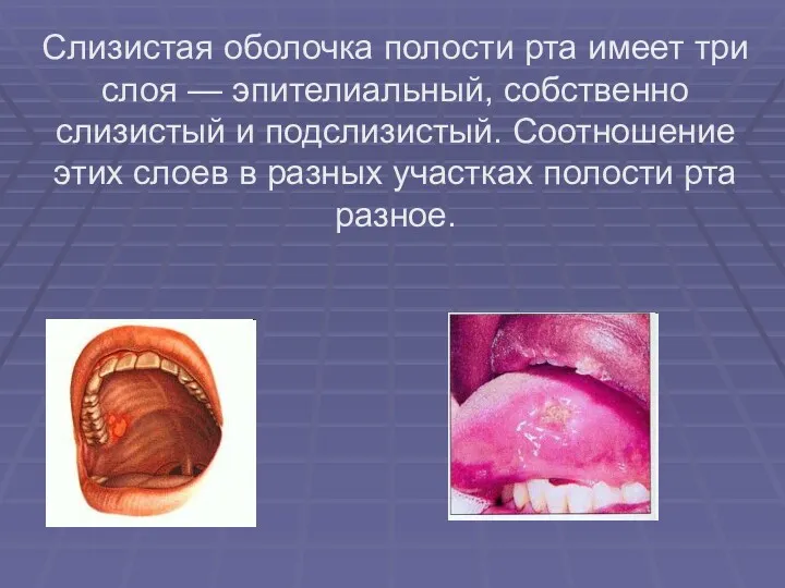 Слизистая оболочка полости рта имеет три слоя — эпителиальный, собственно