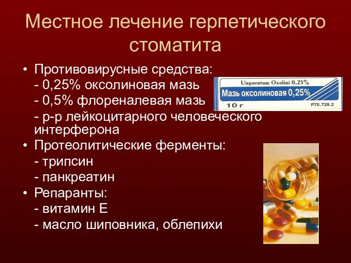 Местное лечение герпетического стоматита Противовирусные средства: - 0,25% оксолиновая мазь