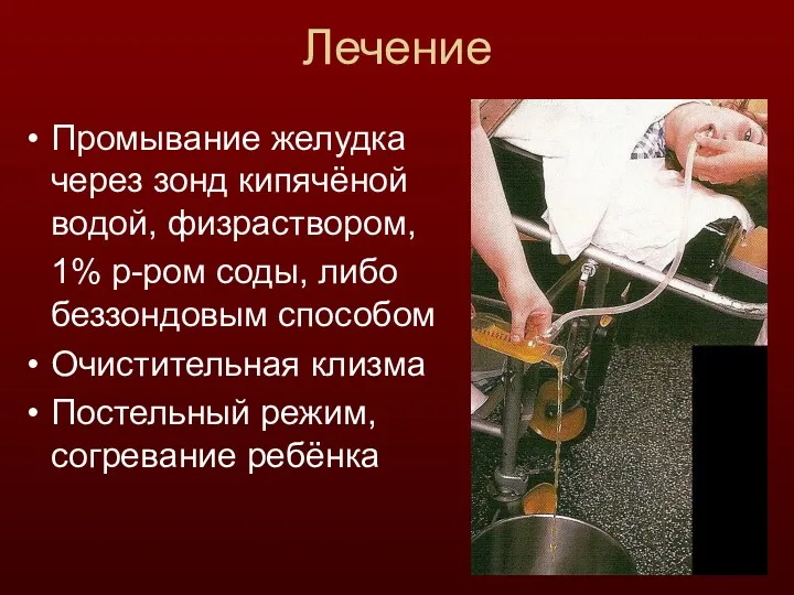 Лечение Промывание желудка через зонд кипячёной водой, физраствором, 1% р-ром