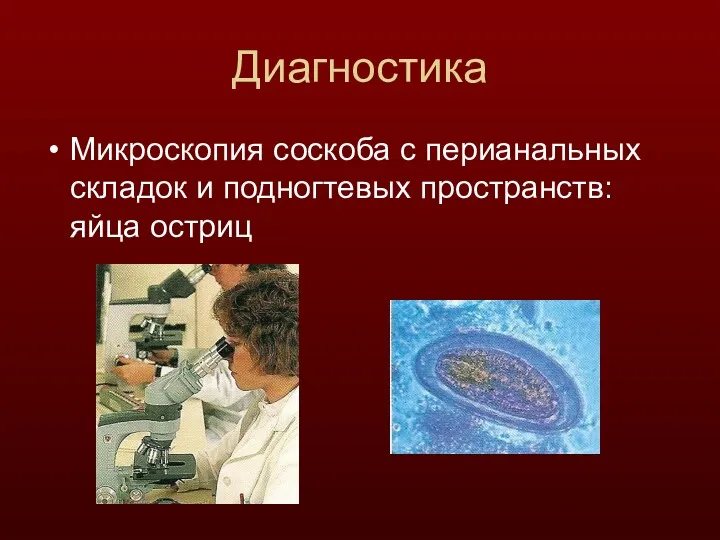 Диагностика Микроскопия соскоба с перианальных складок и подногтевых пространств: яйца остриц