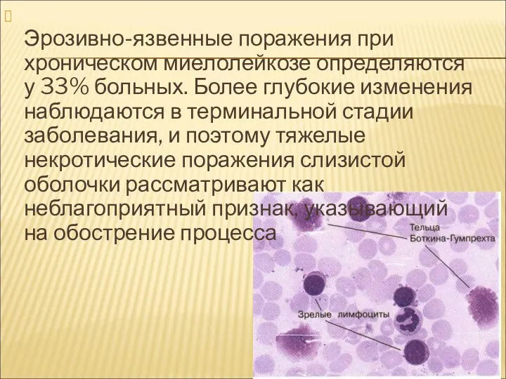 Эрозивно-язвенные поражения при хроническом миелолейкозе определяются у 33% больных. Более