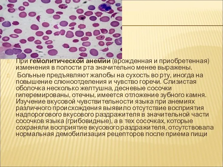 При гемолитической анемии (врожденная и приобретенная) изменения в полости рта