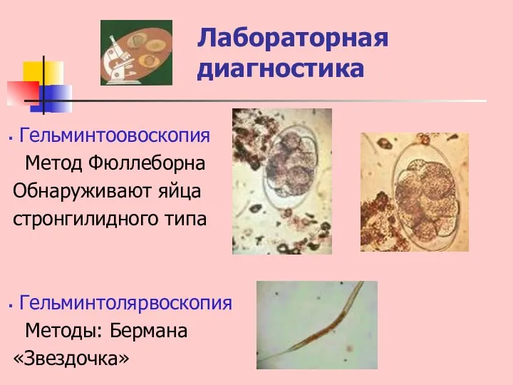 Лабораторная диагностика Гельминтоовоскопия Метод Фюллеборна Обнаруживают яйца стронгилидного типа Гельминтолярвоскопия Методы: Бермана «Звездочка»