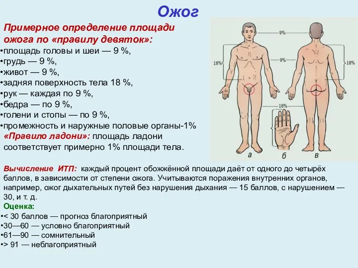 Примерное определение площади ожога по «правилу девяток»: площадь головы и