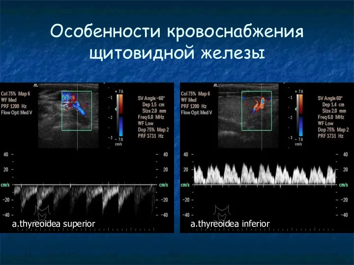 Особенности кровоснабжения щитовидной железы a.thyreoidea superior a.thyreoidea inferior