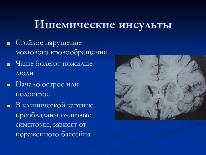 Ишемические инсульты Стойкое нарушение мозгового кровообращения Чаще болеют пожилые люди