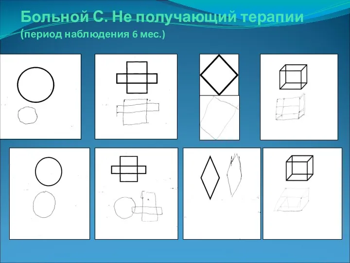 Больной С. Не получающий терапии (период наблюдения 6 мес.)