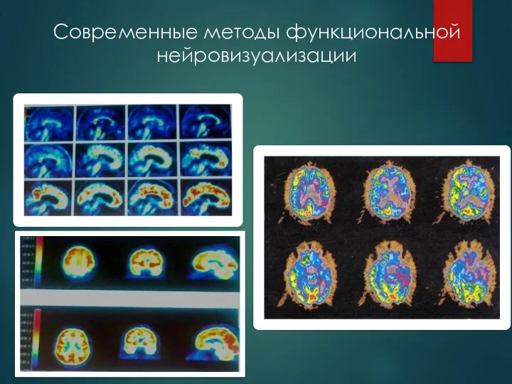 Современные методы функциональной нейровизуализации