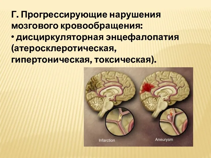 Г. Прогрессирующие нарушения мозгового кровообращения: • дисциркуляторная энцефалопатия (атеросклеротическая, гипертоническая, токсическая).