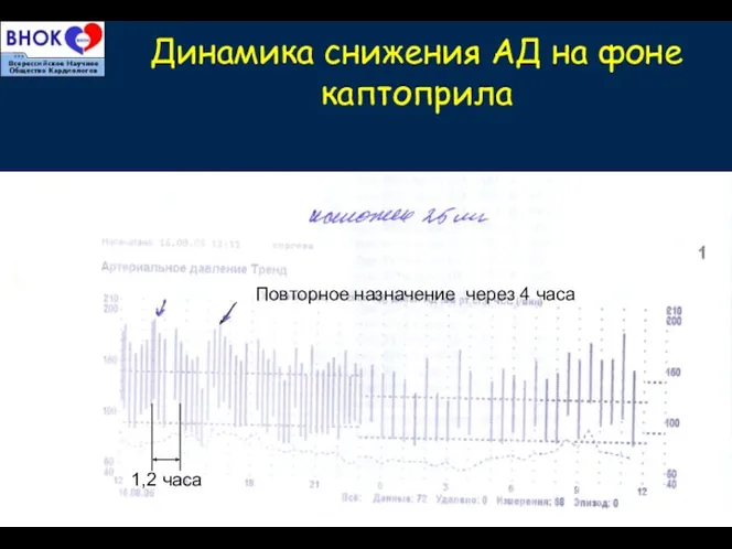 Динамика снижения АД на фоне каптоприла 1,2 часа Повторное назначение через 4 часа