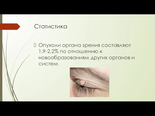 Статистика Опухоли органа зрения составляют 1,9-2,2% по отношению к новообразованиям других органов и систем