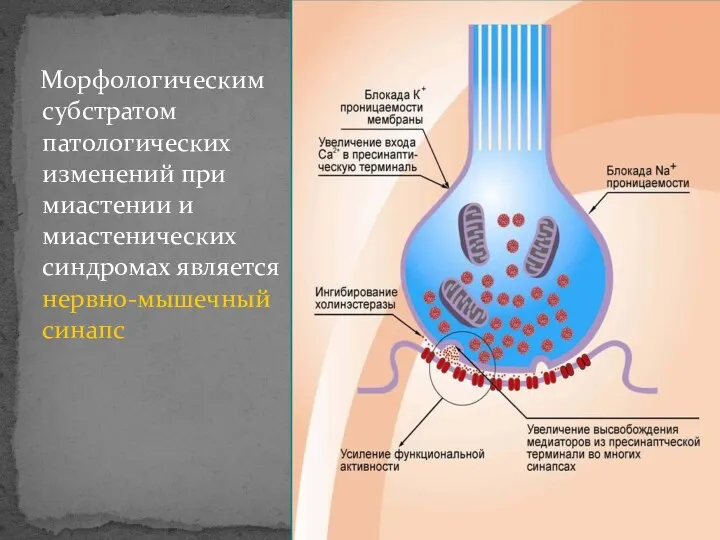 Морфологическим субстратом патологических изменений при миастении и миастенических синдромах является нервно-мышечный синапс