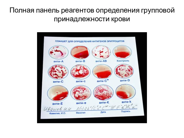 Полная панель реагентов определения групповой принадлежности крови