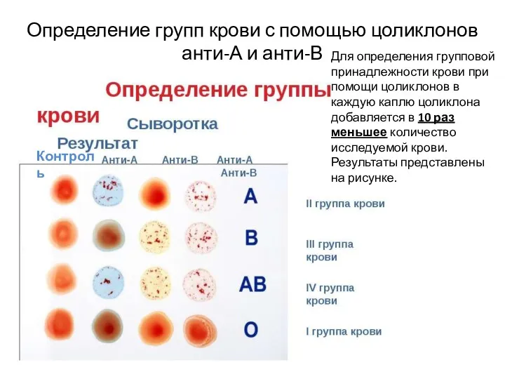 Определение групп крови с помощью цоликлонов анти-А и анти-В Для определения групповой принадлежности