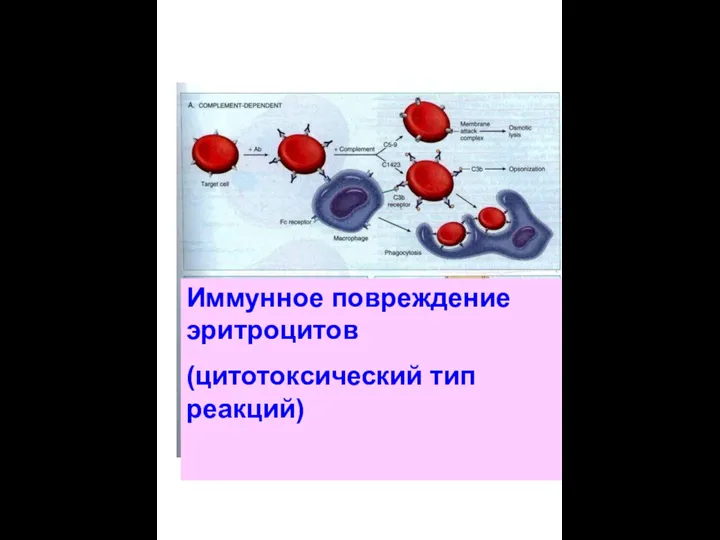 Иммунное повреждение эритроцитов (цитотоксический тип реакций)