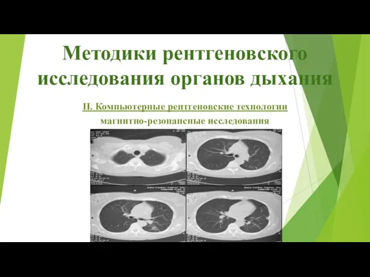 Методики рентгеновского исследования органов дыхания ІІ. Компьютерные рентгеновские технологии магнитно-резонансные исследования