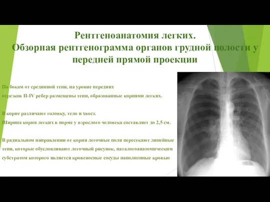 Рентгеноанатомия легких. Обзорная рентгенограмма органов грудной полости у передней прямой