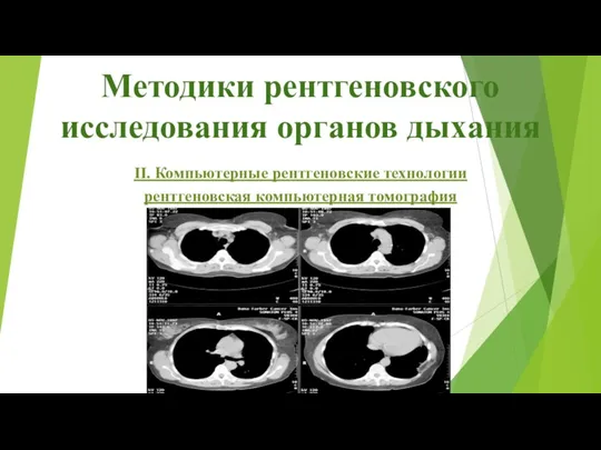 Методики рентгеновского исследования органов дыхания ІІ. Компьютерные рентгеновские технологии рентгеновская компьютерная томография