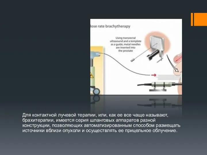 Для контактной лучевой терапии, или, как ее все чаще называют,