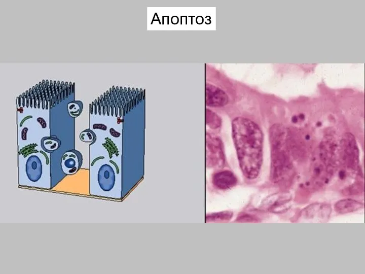 Апоптоз