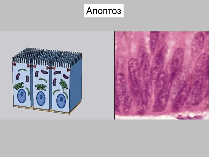 Апоптоз