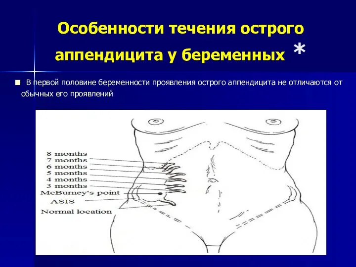 Особенности течения острого аппендицита у беременных * В первой половине