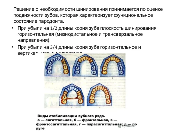 Решение о необходимости шинирования принимается по оценке подвижности зубов, которая