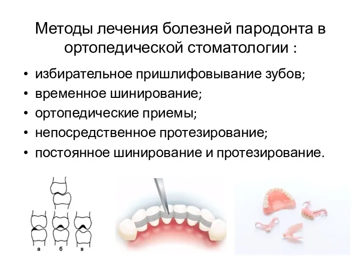 Методы лечения болезней пародонта в ортопедической стоматологии : избирательное пришлифовывание