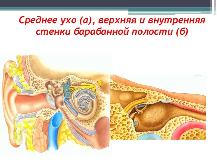 Cреднее ухо (а), верхняя и внутренняя стенки барабанной полости (б)