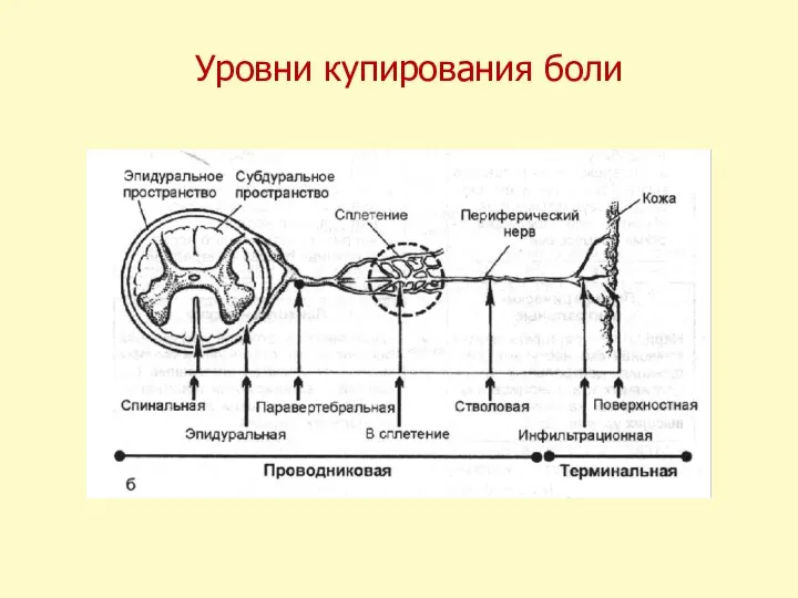 Уровни купирования боли