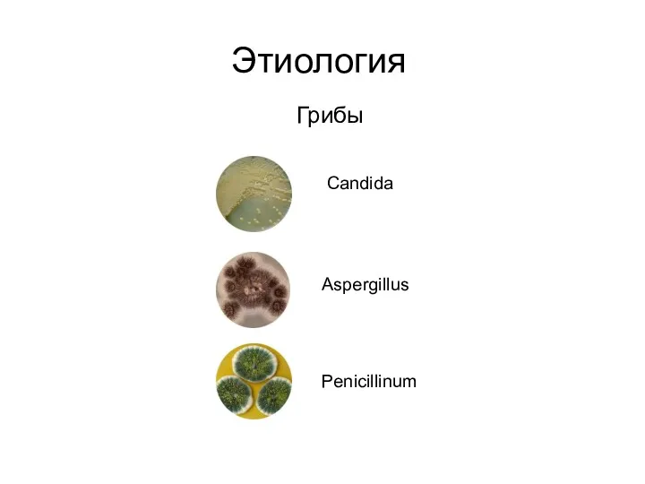 Этиология Грибы Candida Aspergillus Penicillinum