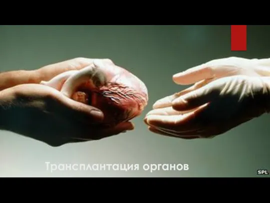 Трансплантация органов