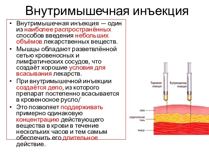 Внутримышечная инъекция Внутримышечная инъекция — один из наиболее распространённых способов