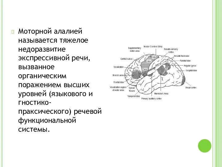 Моторной алалией называется тяжелое недоразвитие экспрессивной речи, вызванное органическим поражением