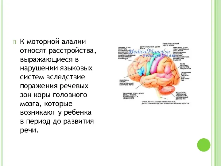 К моторной алалии относят расстройства, выражающиеся в нарушении языковых систем