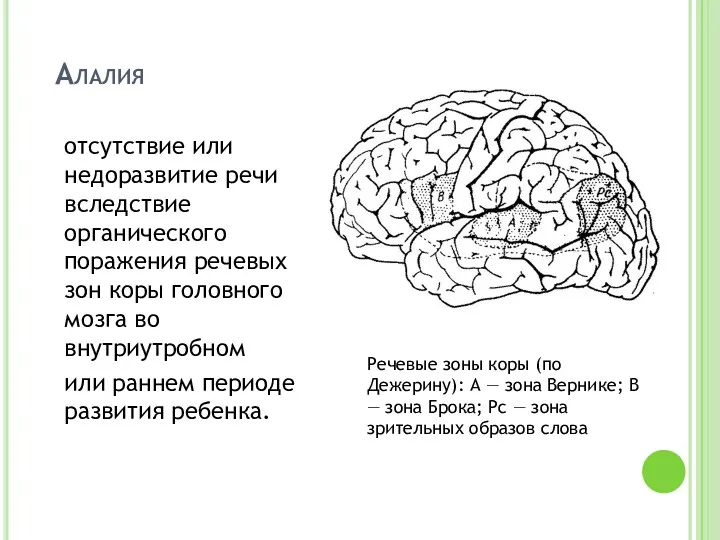 Алалия отсутствие или недоразвитие речи вследствие органического поражения речевых зон