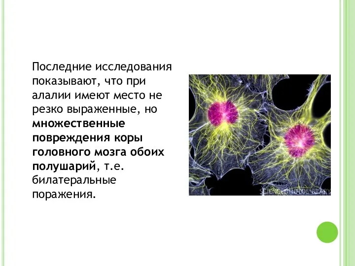 Последние исследования показывают, что при алалии имеют место не резко