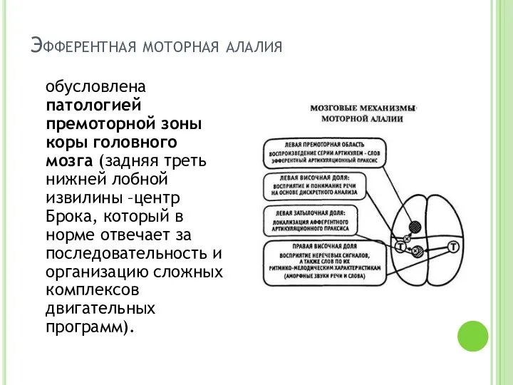 Эфферентная моторная алалия обусловлена патологией премоторной зоны коры головного мозга