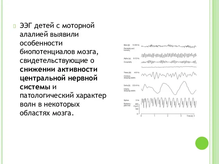 ЭЭГ детей с моторной алалией выявили особенности биопотенциалов мозга, свидетельствующие