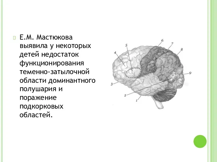 Е.М. Мастюкова выявила у некоторых детей недостаток функционирования теменно-затылочной области доминантного полушария и поражение подкорковых областей.