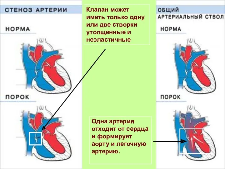 Одна артерия отходит от сердца и формирует аорту и легочную