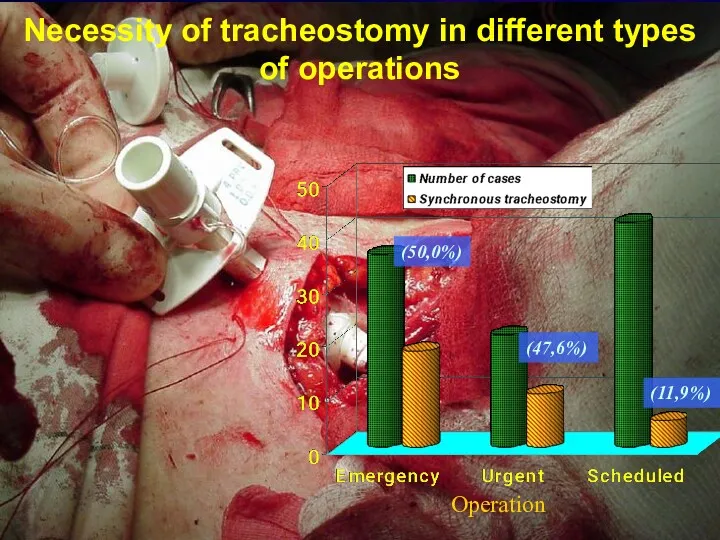 Necessity of tracheostomy in different types of operations (50,0%) (47,6%) (11,9%) Operation