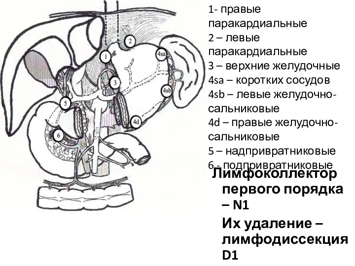 Лимфоколлектор первого порядка – N1 Их удаление – лимфодиссекция D1 1- правые паракардиальные