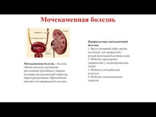 Мочекаменная болезнь Мочекаменная болезнь - болезнь обмена веществ, вызванная различными причинами, нередко носящая